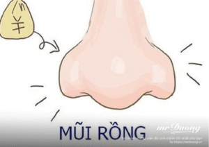 Mũi tài lộc