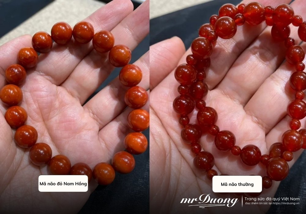 khoa-hoc-da-quy-hieu-ro-su-khac-biet-giua-da-ma-nao-do-mien-nam-va-da-ma-nao-thong-thuong-chi-qua-mot-hinh-anh