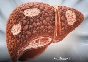 loi-thu-nhan-cua-mot-la-gan